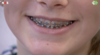 Previous