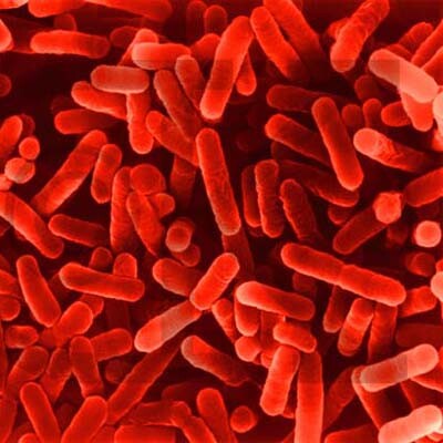 Override of the title legionella
