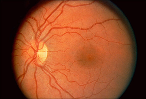 Override of the title Noorderlicht - retina