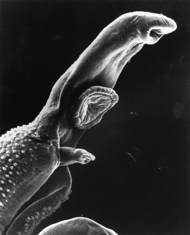 schistosoma