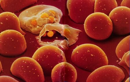 Override of the title Noorderlicht: nieuws malaria