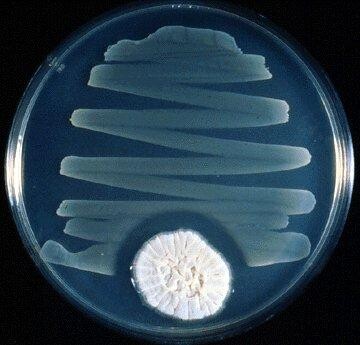 Override of the title Bacteriekweek