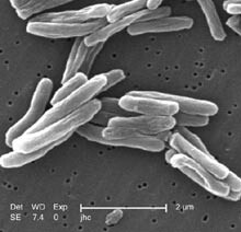 Override of the title Mycobacterium tuberculosis