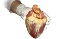 hand met hart