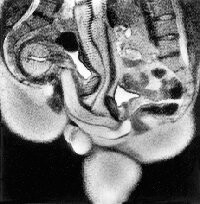 Noorderlicht MRI neuken