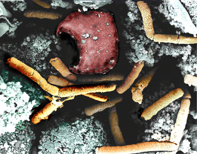 Override of the title Noorderlicht antibioticaresistentie