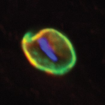 Override of the title Noorderlicht: nieuws malaria
