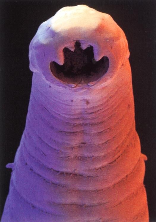 Mijnworm (Ancylostoma duodenale)